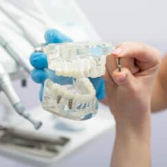 Dentist in Mentor Demonstrating How Dental Crowns and Bridges Work
