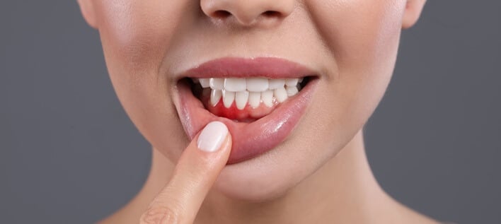 Decades of Experience Managing All Stages of Gum Disease In North Olmsted